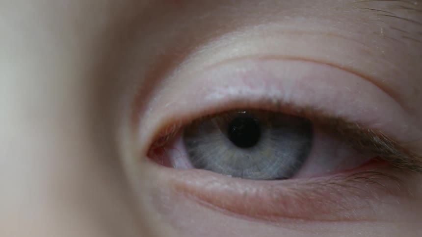 A human blinks their eye