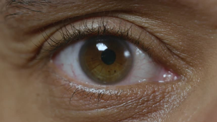 An eyeball is displayed and is opened wide