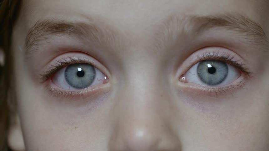 A child staring into the camera with wide grey eyes
