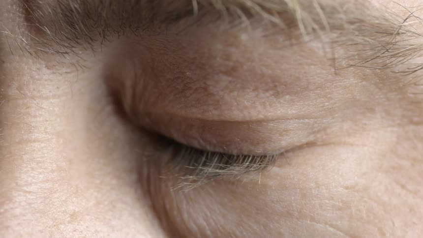 Persons eye blinking