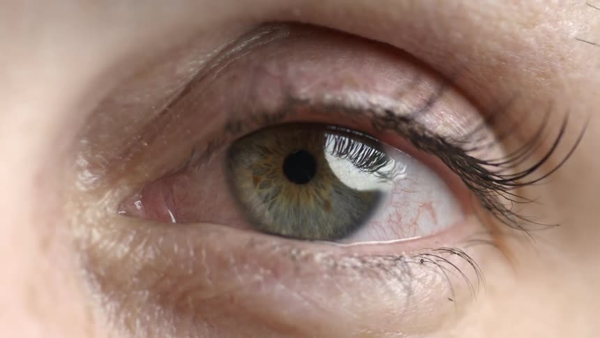 A person with a bloodshot eye