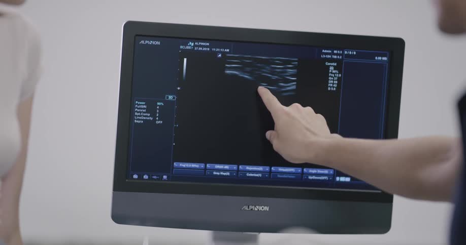 A patient is having a sonogram on the knee