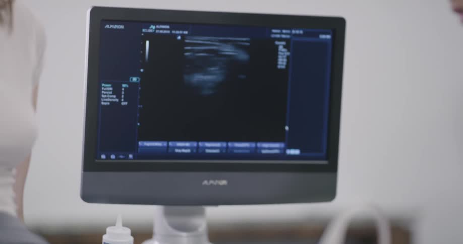 A medical professional explains a sonogram on a monitor over a patient