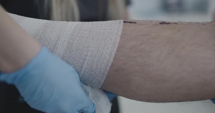 A person unwraps a bandage off of another persons leg