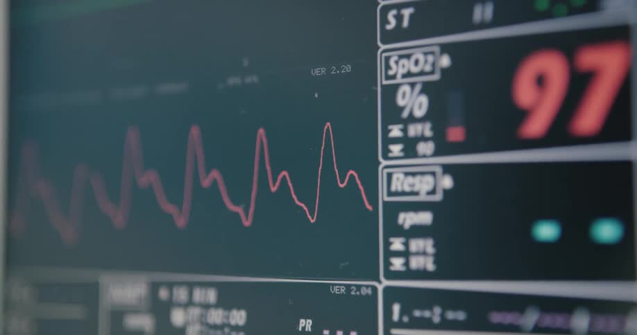 A heart rate monitor can be seen as it tracks a multitude of patient vitals such as blood oxygen saturation