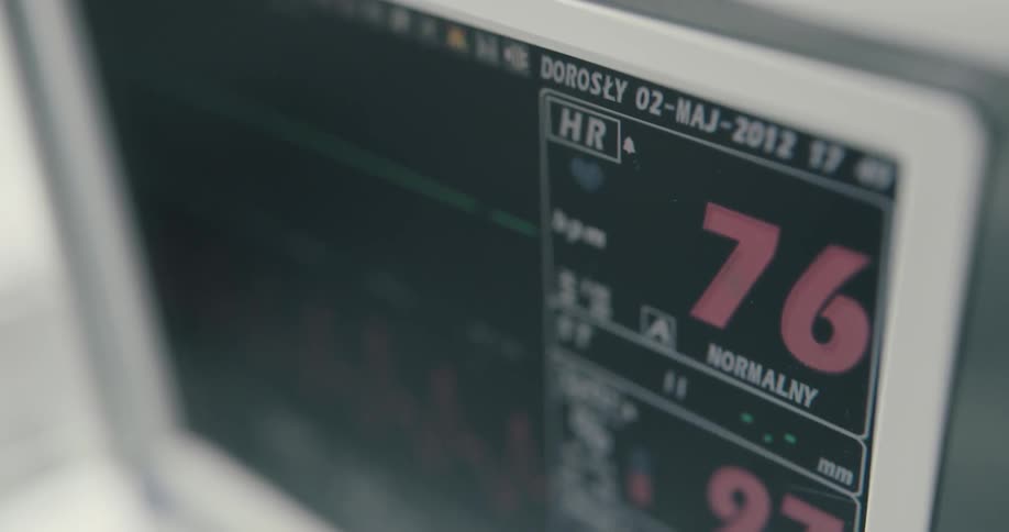 A hospital monitor is showing a patients heart rate which is beating at seventy five beate per minute