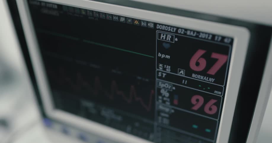 A medical monitor displays patient vitals