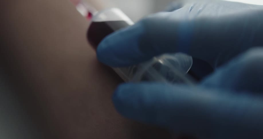 A doctor is drawing blood from a patient