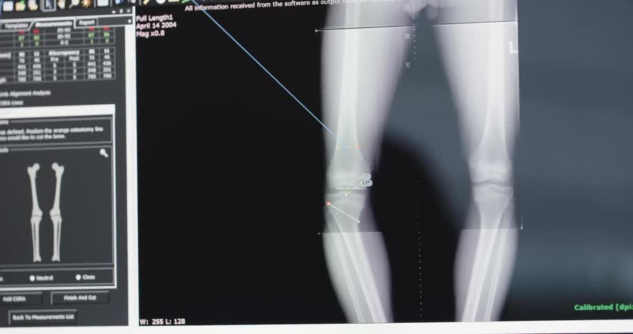 A monitor displaying human joint and anatomy