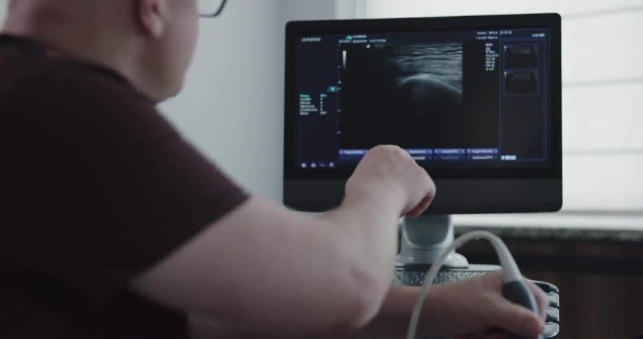 A nurse performing an ultrasound on the knee of a patient