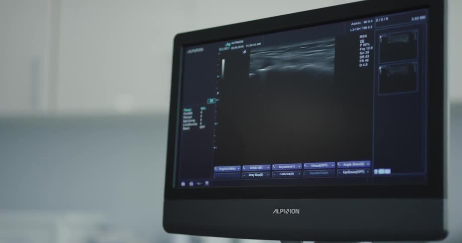 Physician showing exam results on screen