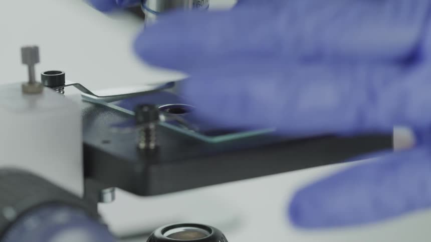 Blood on a slide under a microscope is being examined by a person
