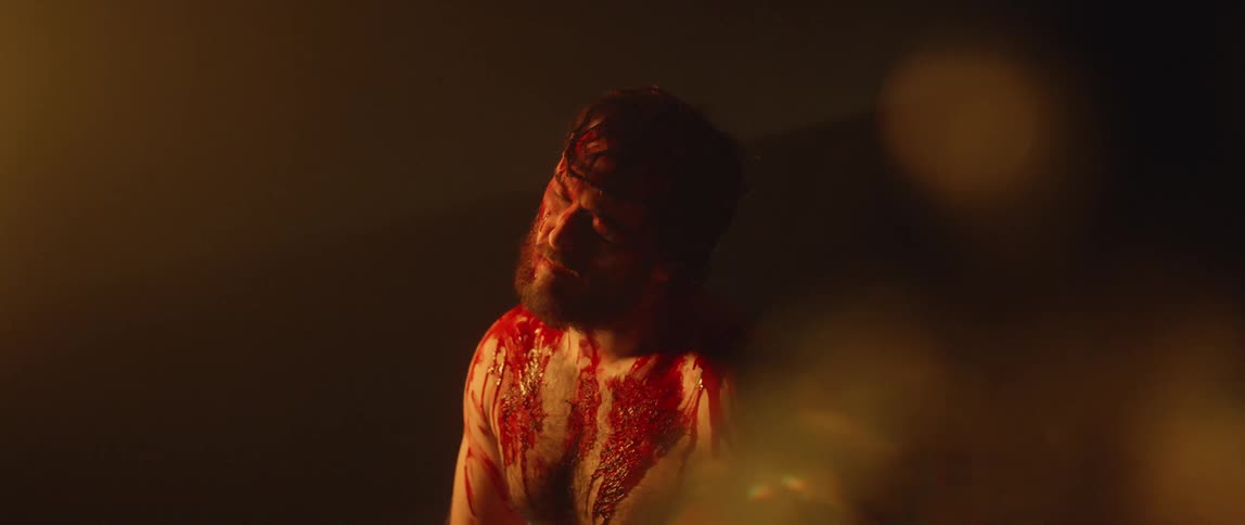 A man sitting down with blood all over his face and body