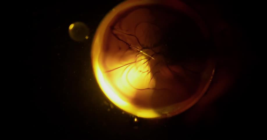 In this highly surreal setting a yellow droplet of fluid has dark strands drifting through it