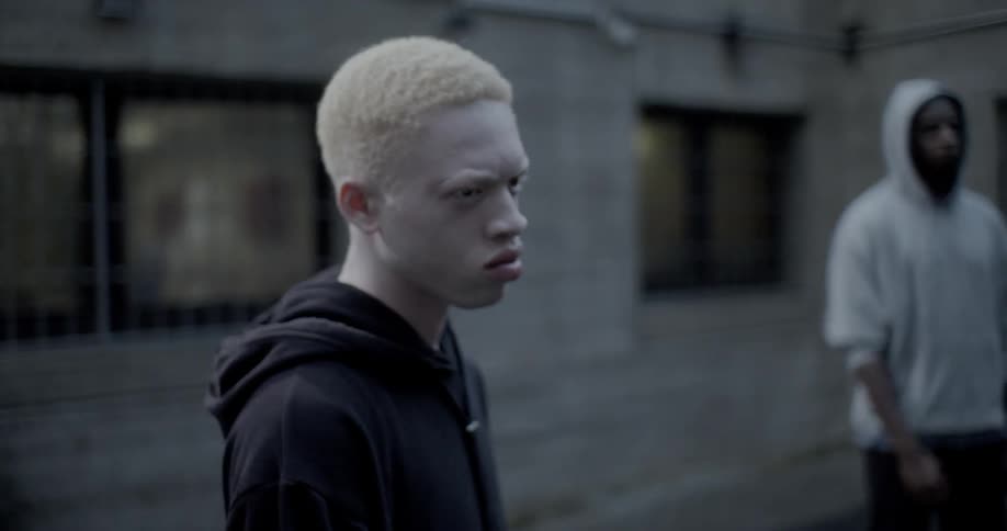 A young albino black male stands outdoors and scowls along with another youngster in a hoodie