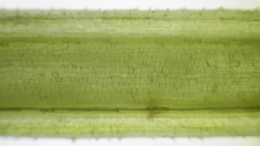 Plant cells shrink in water under a microscope
