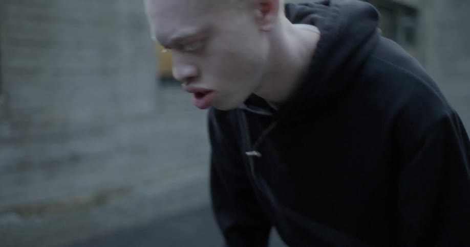 An albino man dribbling a basketball outdoors
