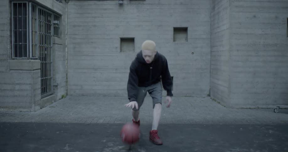 Albino man picks up basketball and starts dribbling