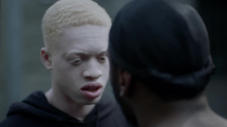 A young man with albinism nods and shakes with fear before another man shoves him back