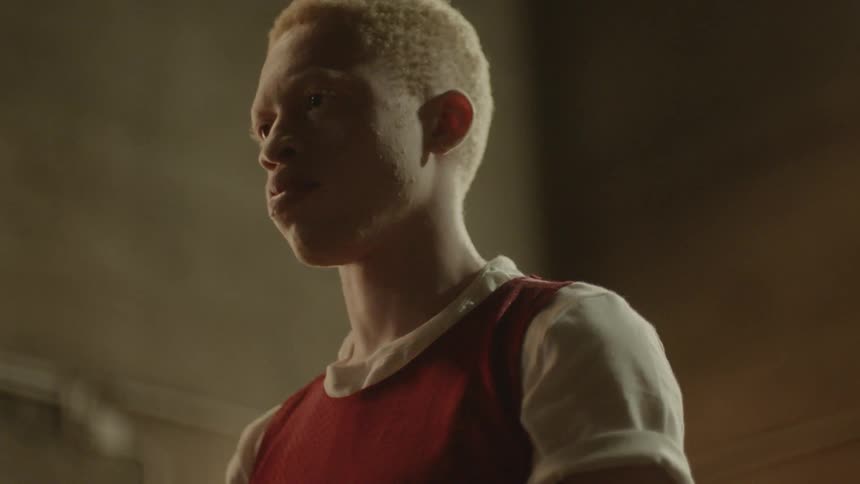 A teenage boy with albinism puts his finger to his lips before passing a basketball