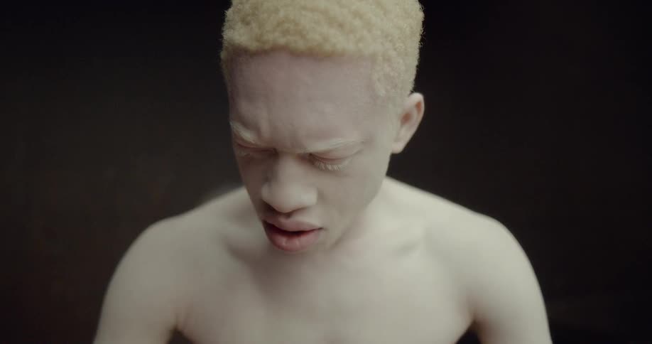 A shirtless man with albinism grimaces as he looks down