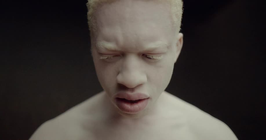 Incredibly pale man stands sadly