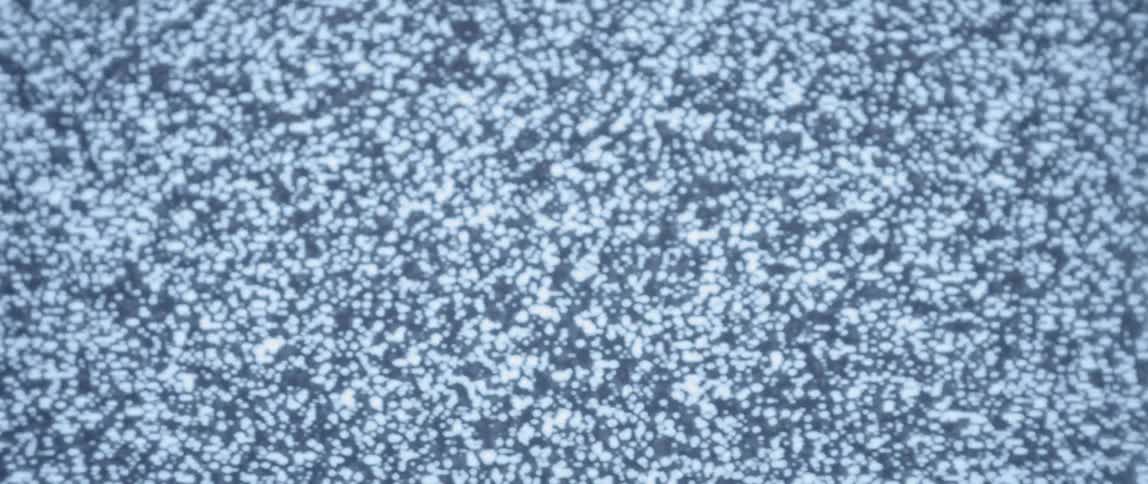 Bad signal static showing on television set