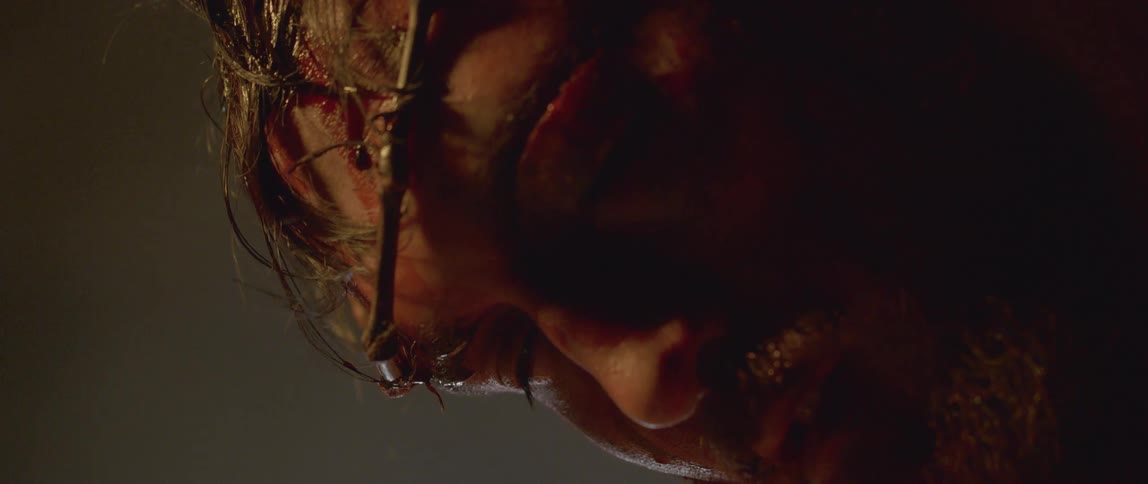 Person wearing crown of thorns and bleeding