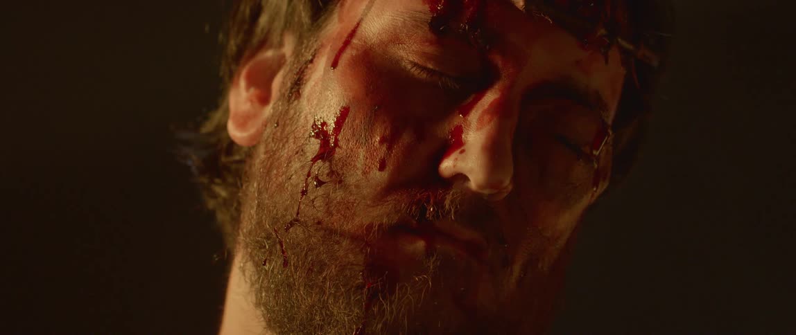 A white man with blood all over his face turns his face with his eyes closed