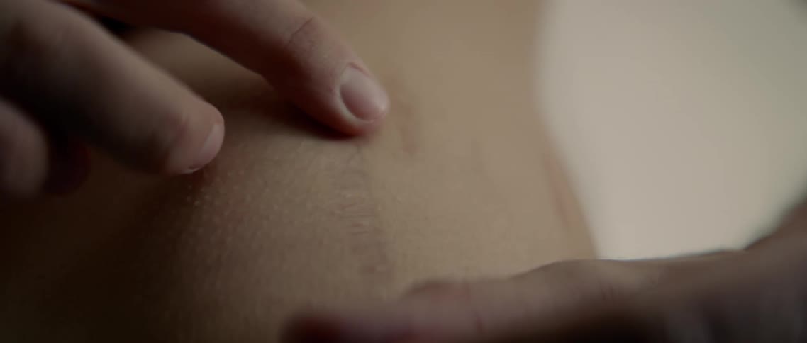 A persons finger caressing a shoulder with a scar