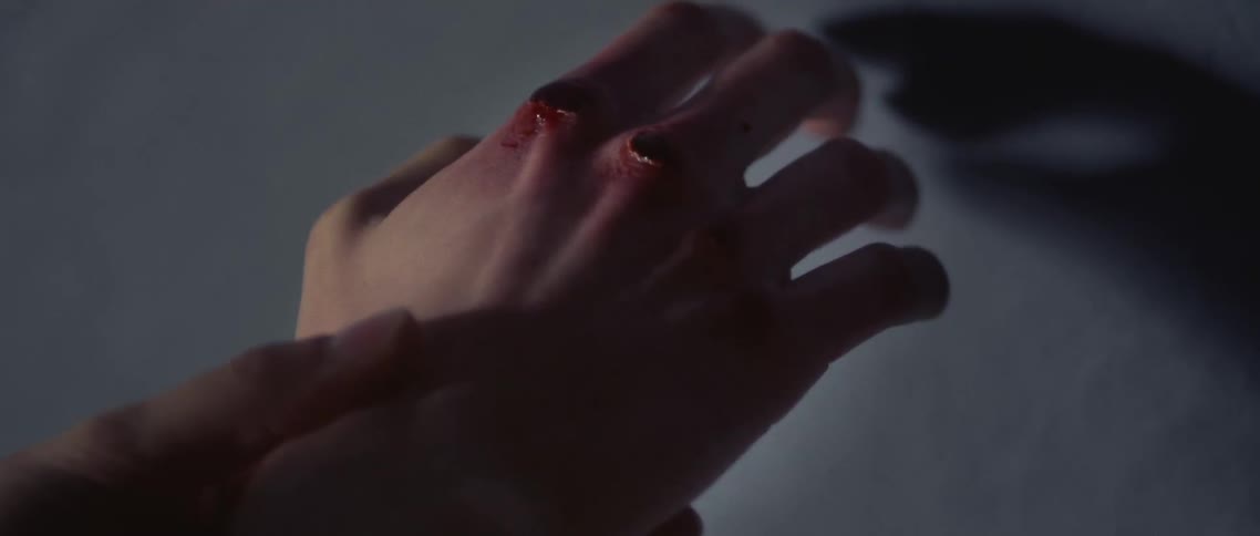 A person holding their hand near a wall with bloodied knuckles
