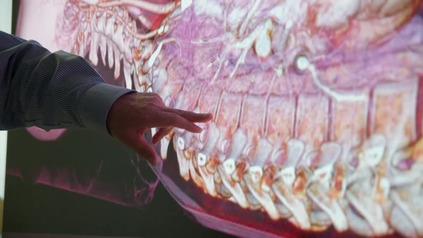 A man points at a screen with a medical image on it