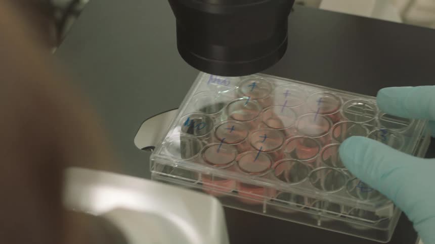 A lab technician places a tray under the microscope