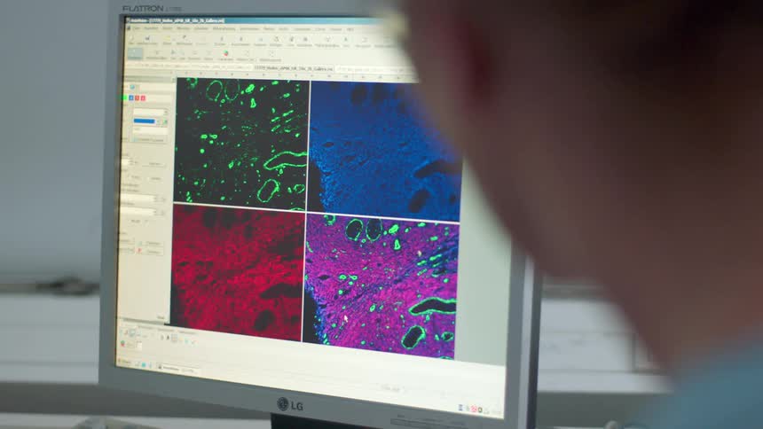 Medical personnel in a hospital look at a monitor with images of cells on it