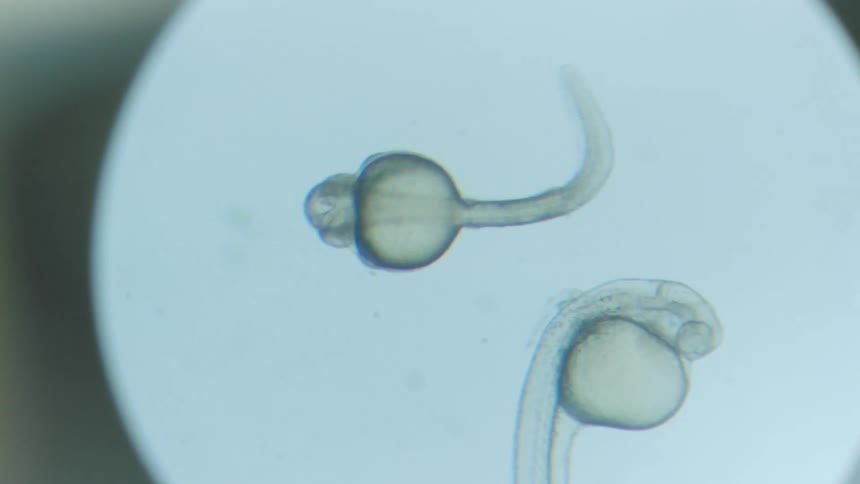 Alive microscopic organism through microscope