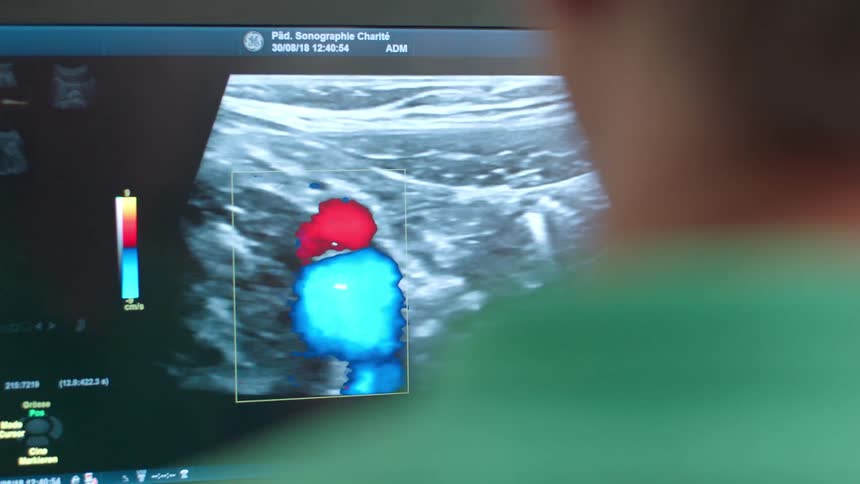 Medical technician looks at a sonograph on a monitor