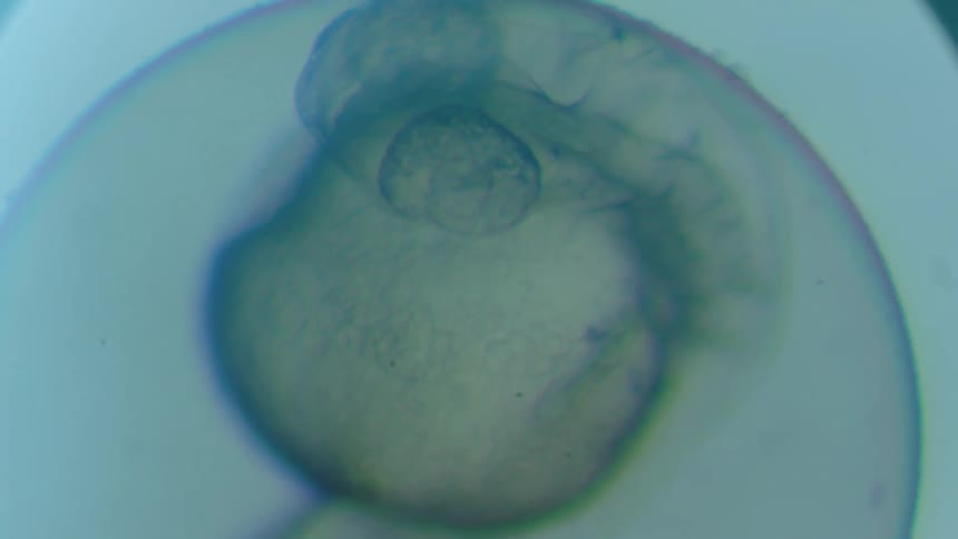 A small cell viewed through a microscope