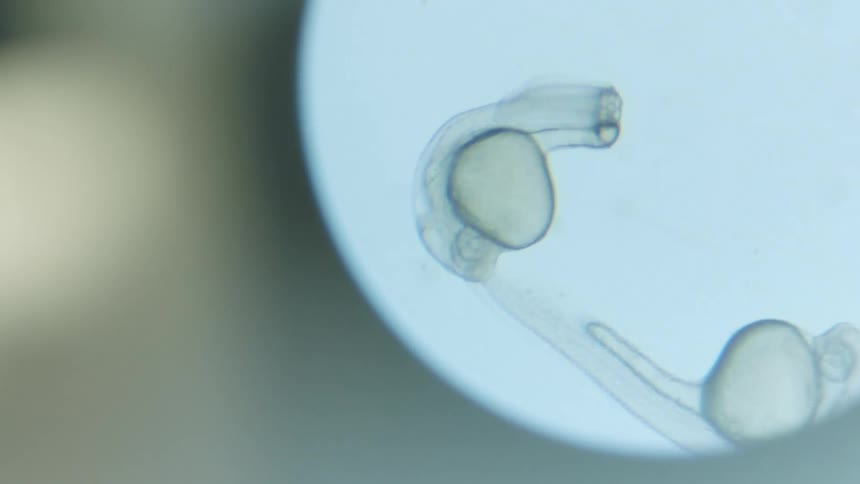 Specimens on a slide under a microscope