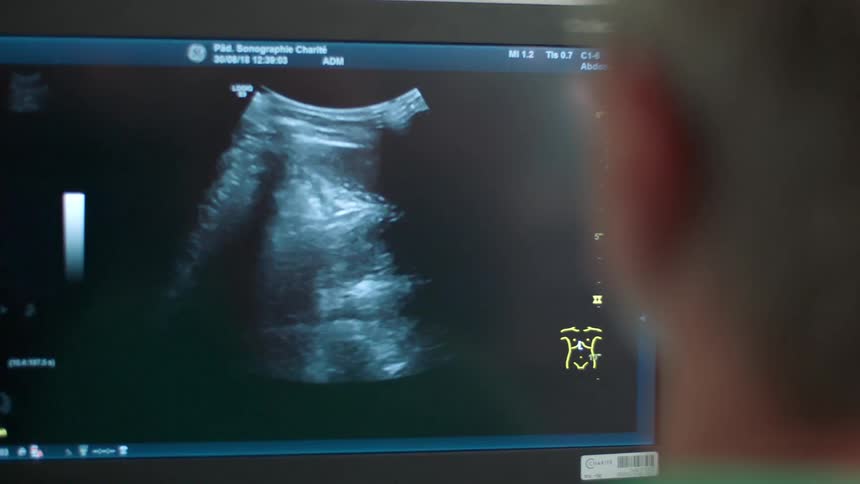 A nurse looking at a sonogram on a monitor