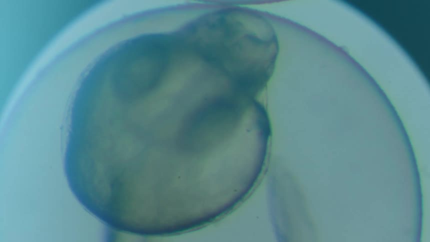 A specimen under a microscope