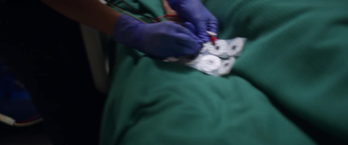 Patient lays unconscious in hospital bed wearing an oxygen mask as one nurse quickly ties a tourniquet to her arm and another nurse attaches lead wires to a strip of electrodes for the monitor