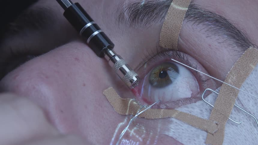 A man lies still as his eye is examined