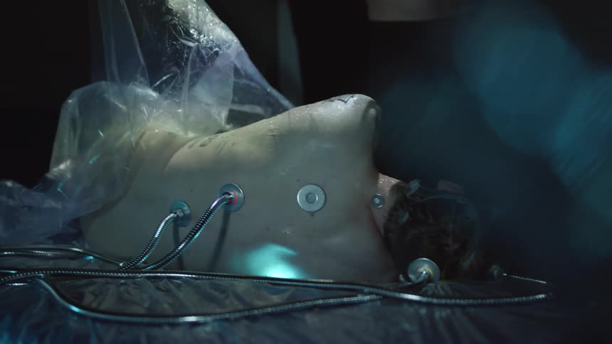 A piece of plastic is pulled off a white person with cables hooked into their back