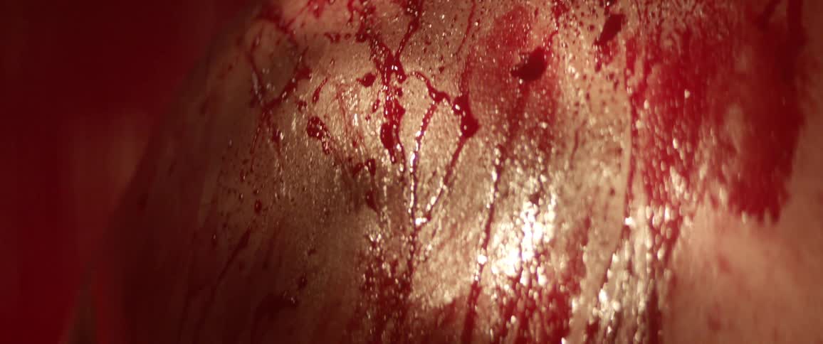Blood covers the arm shoulder and back of a man