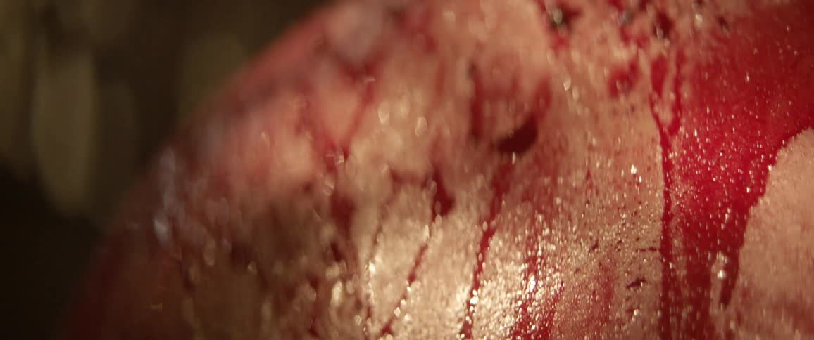 A white man with a large amount of blood covering his shoulder and back