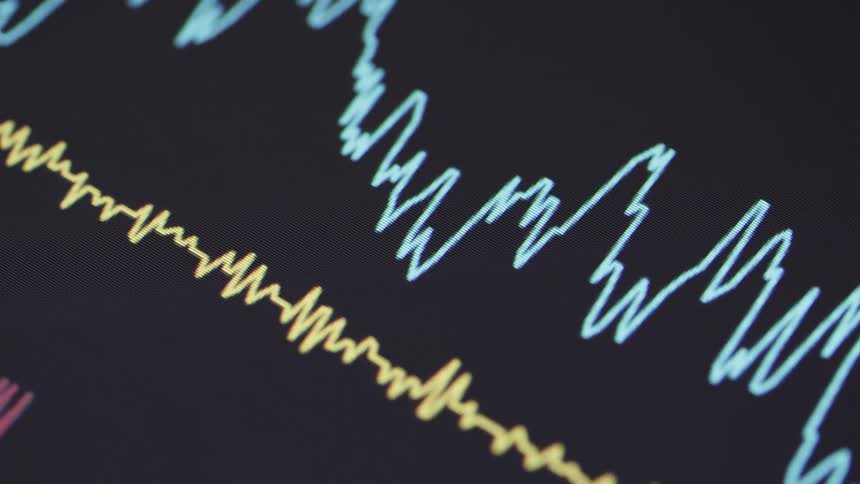 Lines on a electrocardiogram monitor show peaks and valleys