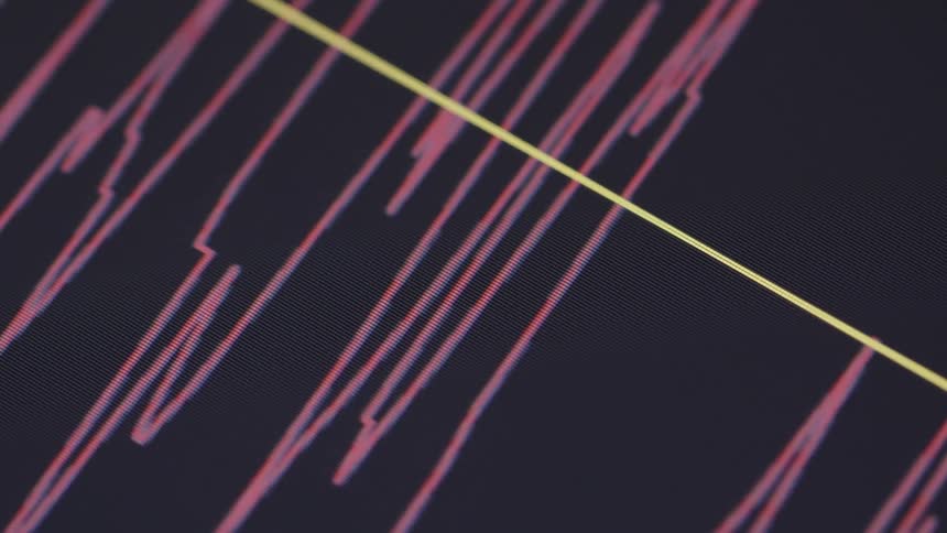The monitor has graph lines displayed