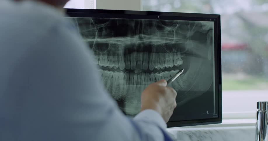 Man points to a computer screen with a pen while he talks