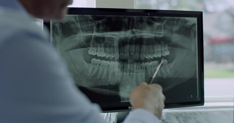 A man talking and pointing at a picture of an x ray of teeth on a screen with a pen