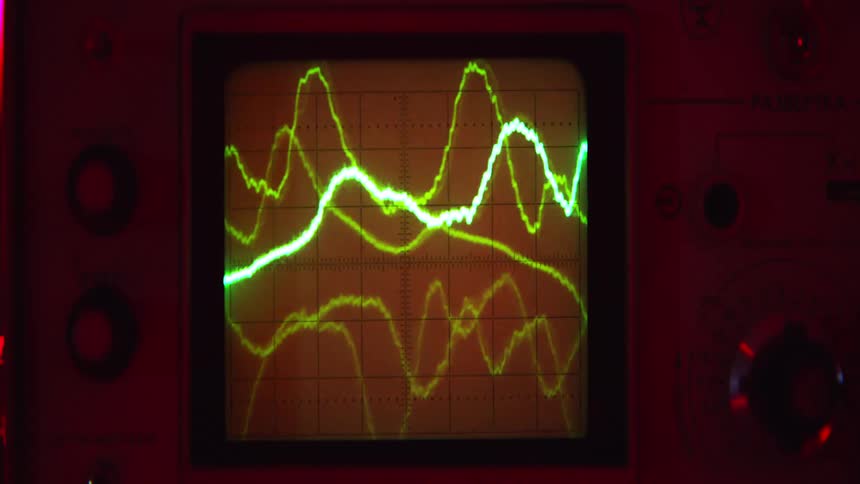 The lines on the monitor move up and down